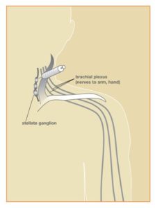 CRPS_Fig1