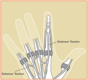 Extensor_Fig1