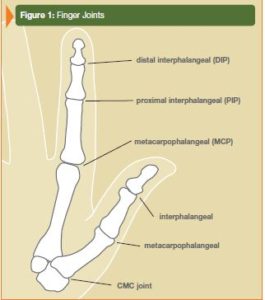 MPJoint_Fig1