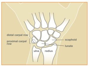 ScaphoidNonUnion_Fig1