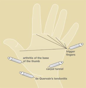 Steroids_fig1