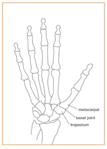 ThumbArthritis_Fig4